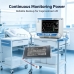 Akkumulátorok kompatibilis a következőkkel Medtronic Capnostream 20 20 Monitor 20P Monitor CS-MPC200MD